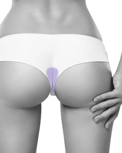 Butt Crack Laser