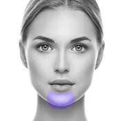 Chin Laser